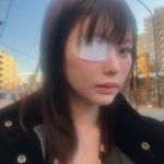 松本丽铃(原明日见未来)被前男友打到受伤。